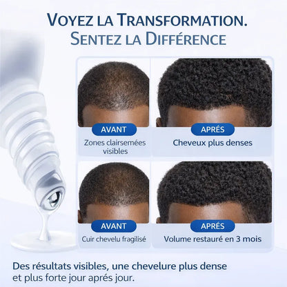 Sérum Capillaire Anti-Chute – Cheveux Plus Épais en 20 Jours